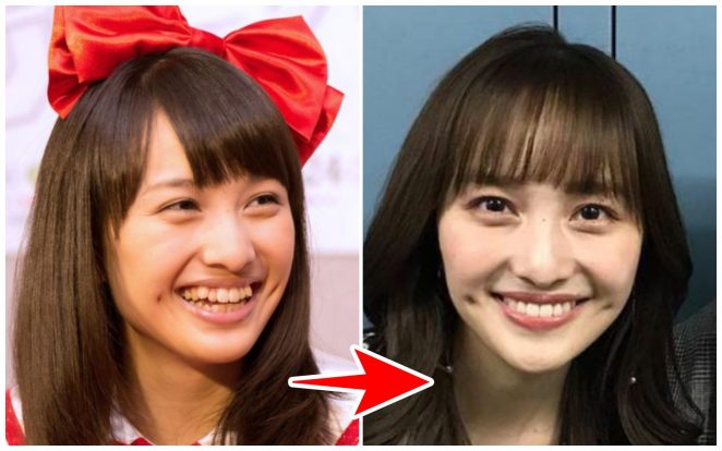 画像 百田夏菜子の顔が変わった理由は八重歯 過去と現在
